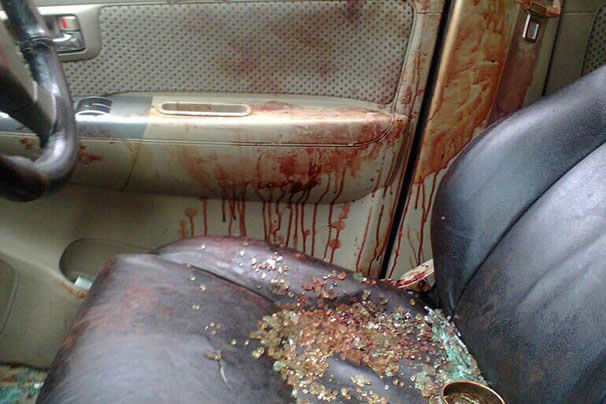 Erotikus játék közben érte a halál a sofőrt 1 Erotikus játék közben érte a halál a sofőrt 1